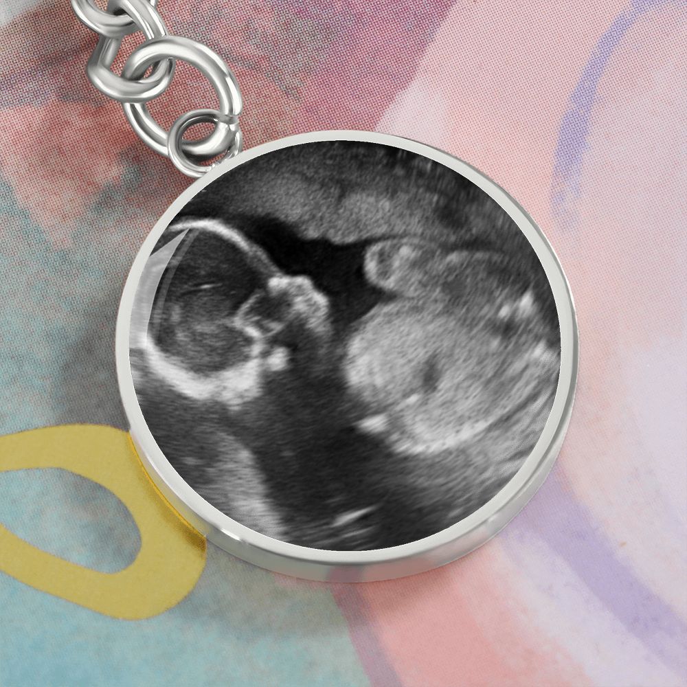 CUSTOM - Casie Keychain