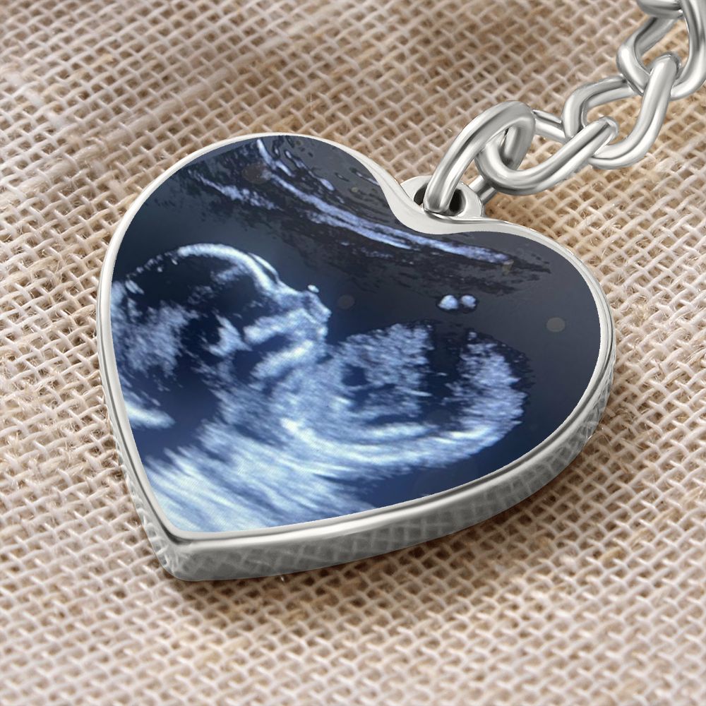 CUSTOM - Ultrasound keychain Ali