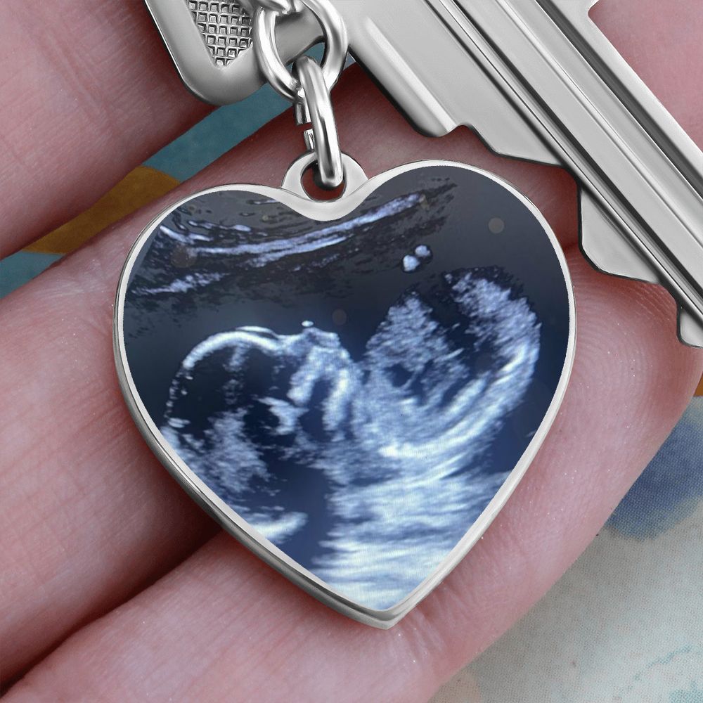 CUSTOM - Ultrasound keychain Ali