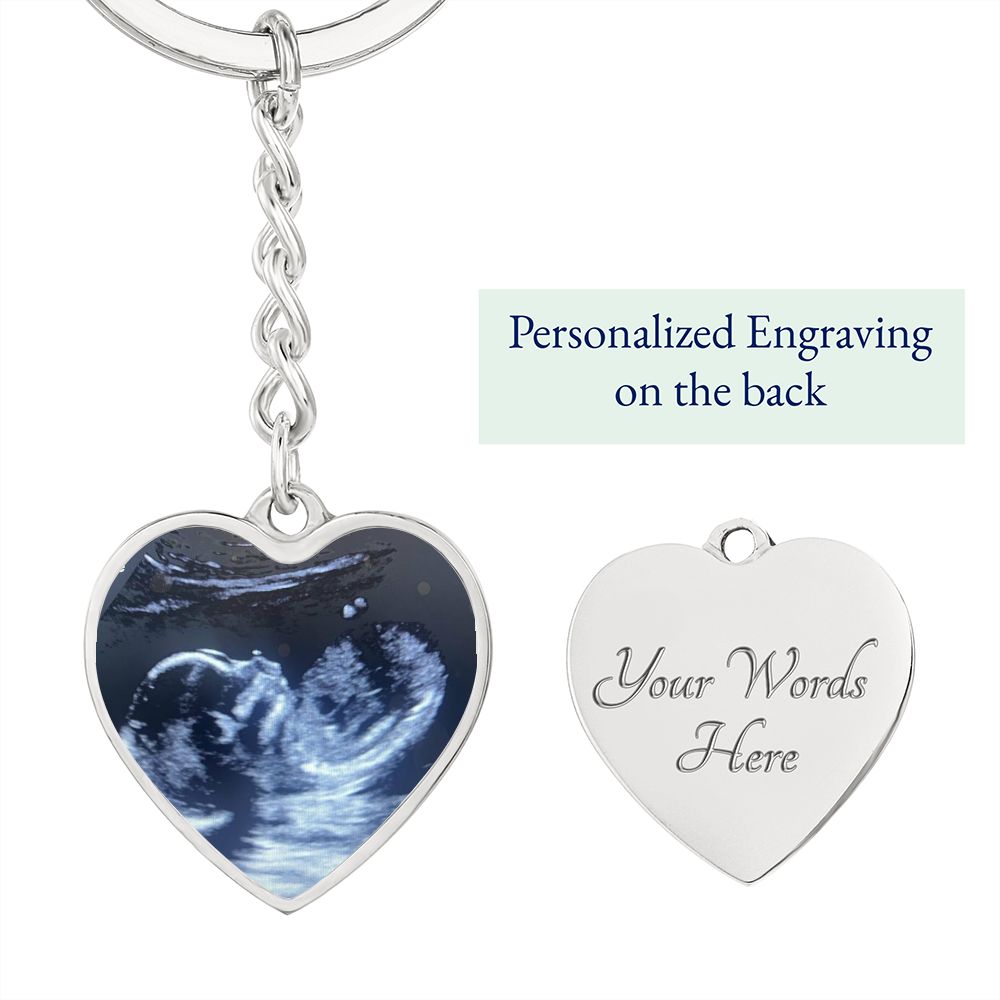 CUSTOM - Ultrasound keychain Ali