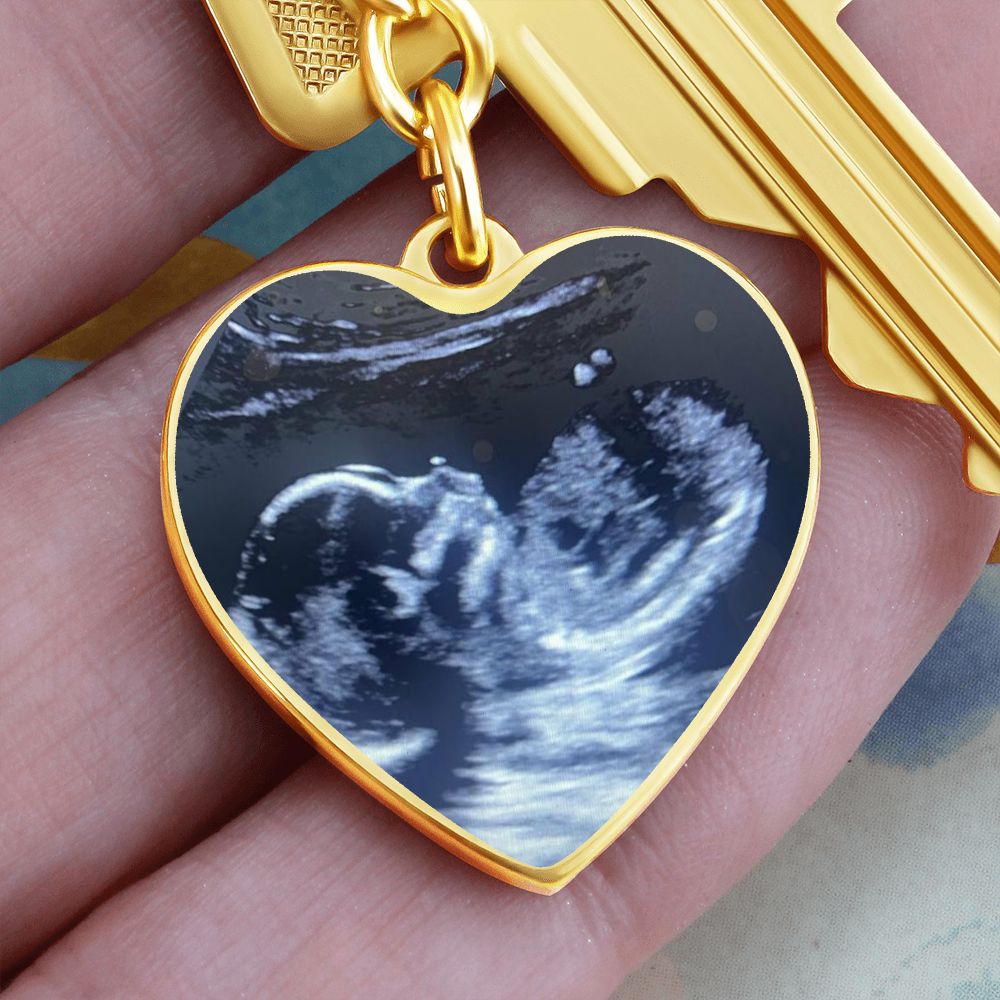 CUSTOM - Ultrasound keychain Ali